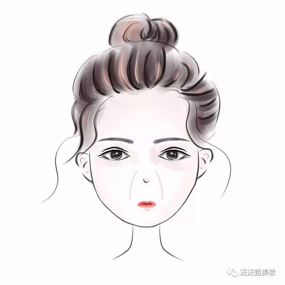 怎样去除法令纹 法令纹怎么消除最快